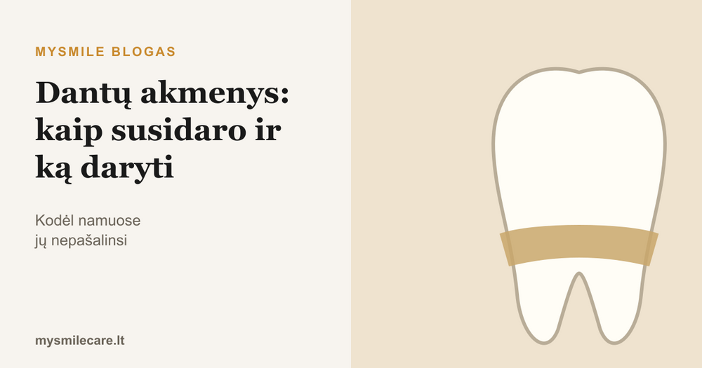 Danties iliustracija su dantų akmenų juosta prie dantenų krašto