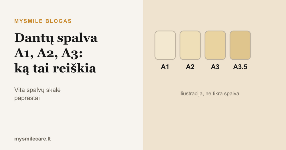 Dantų spalvos A1, A2, A3 ir A3.5 atspalvių iliustracija