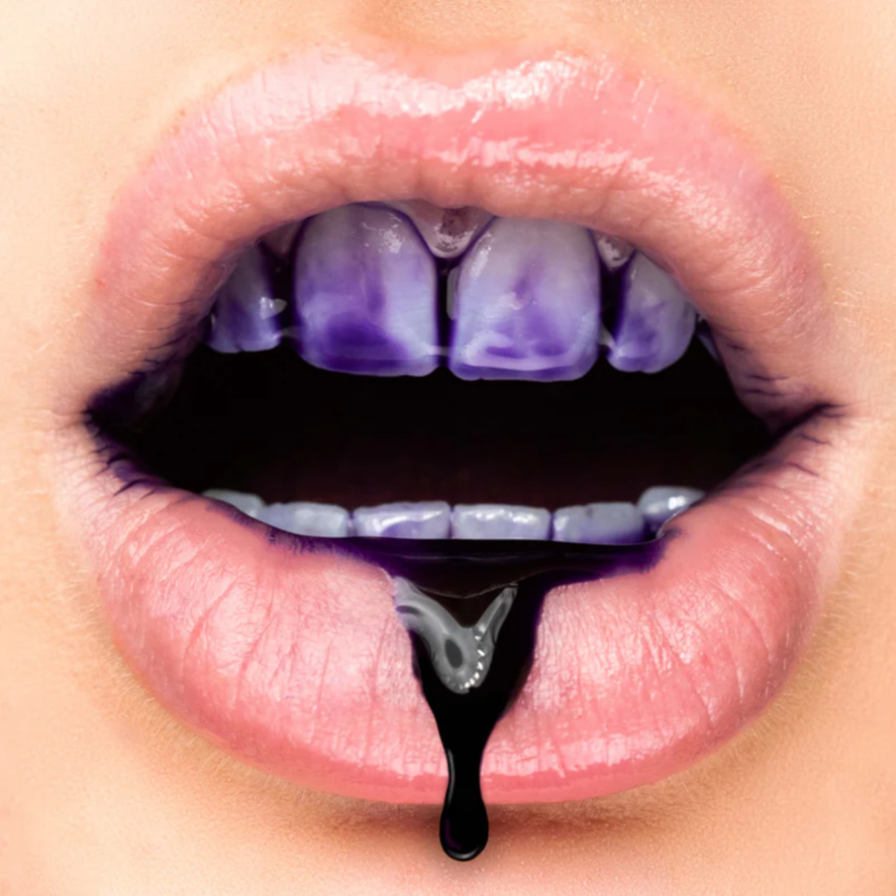 MySmile | V34 Violetinis Dantų Spalvos Korektorius